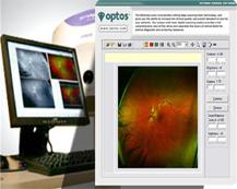 OptoMap machine and results